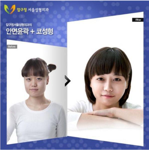samaze_010-869