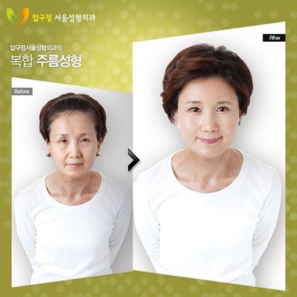 samaze_013-824