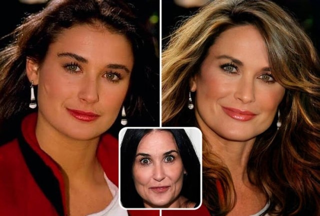 celebritieswithoutplasticsurgeries_004