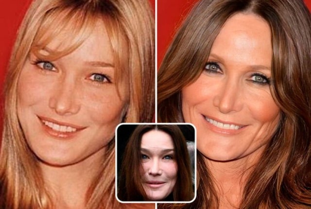 celebritieswithoutplasticsurgeries_010