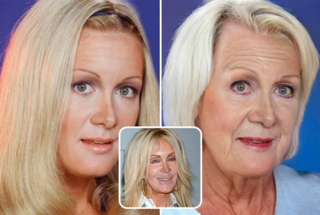 celebritieswithoutplasticsurgeries_021