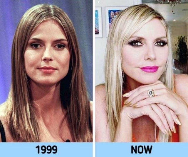 90scelebritiesthenandnow_009