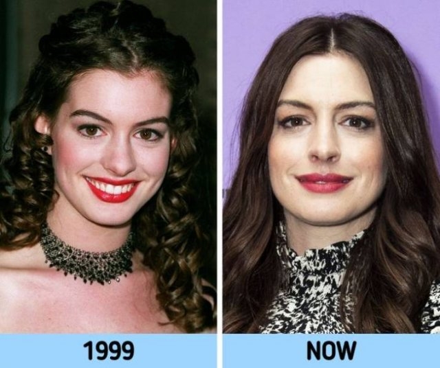 90scelebritiesthenandnow_018