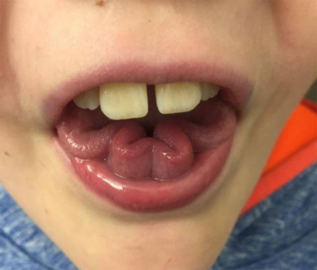 bodyfacts_015 bodyfacts_015