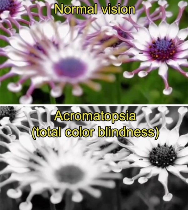 visionimpairments_004