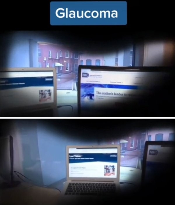 visionimpairments_011