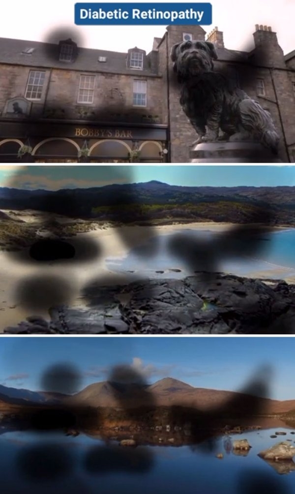 visionimpairments_014