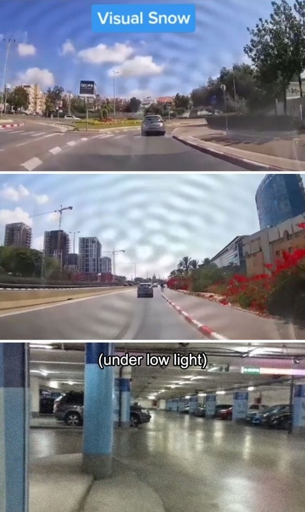 visionimpairments_016