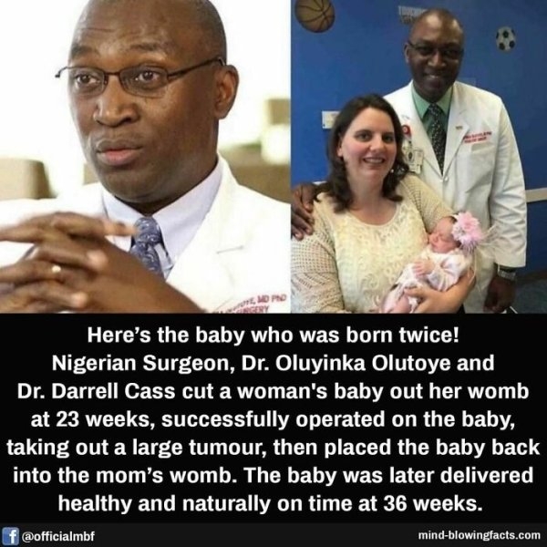 interestingfacts15_028