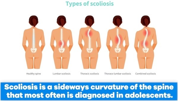 interestingdata17_015