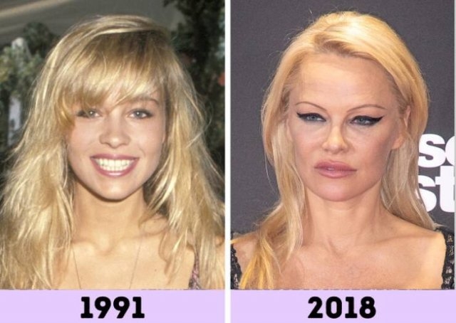 celebritiesthennow8_012