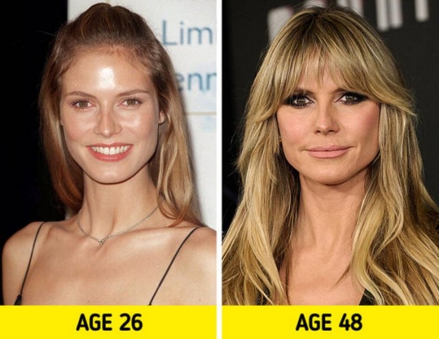 celebritiesthennow9_004