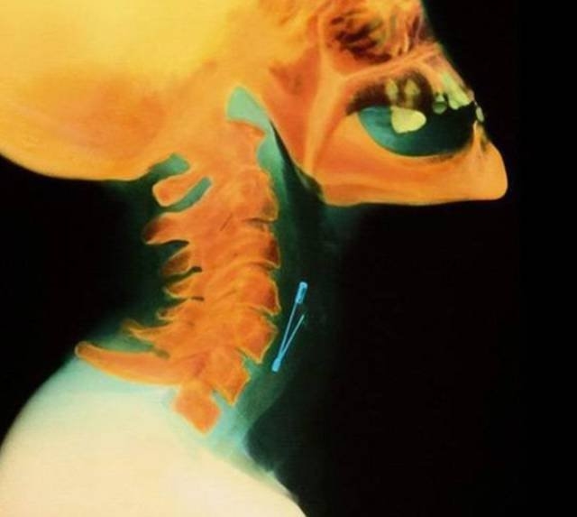 xrays_003