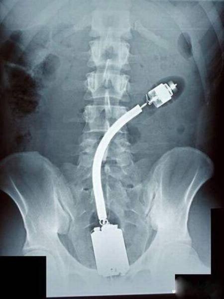 xrays_005