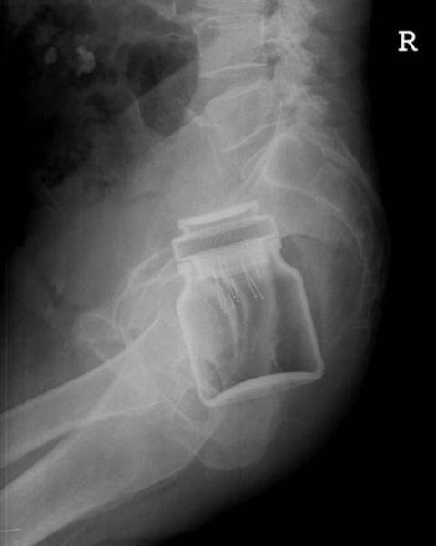 xrays_006