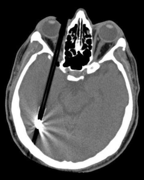 xrays_009