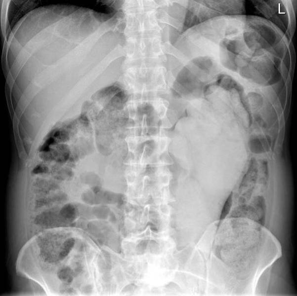 xrays_011
