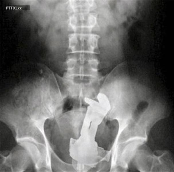 xrays_012