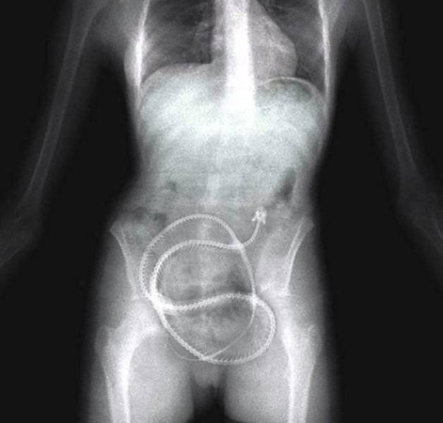 xrays_013