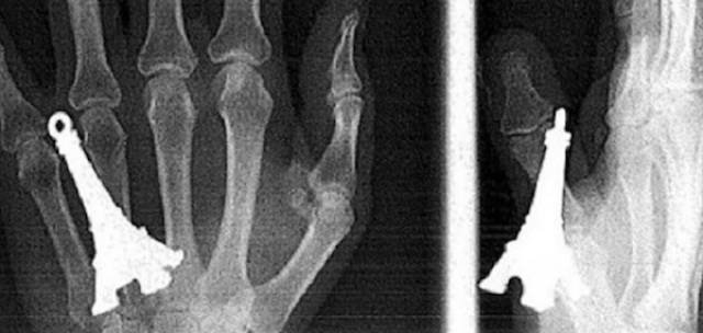 xrays_014