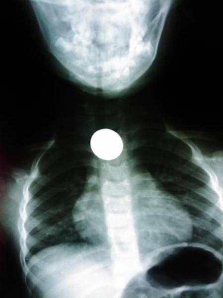 xrays_015