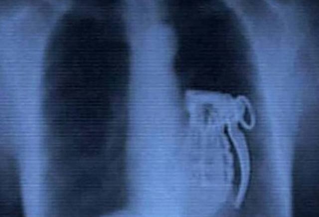 xrays_016