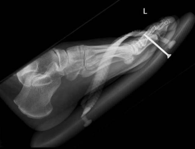 xrays_017
