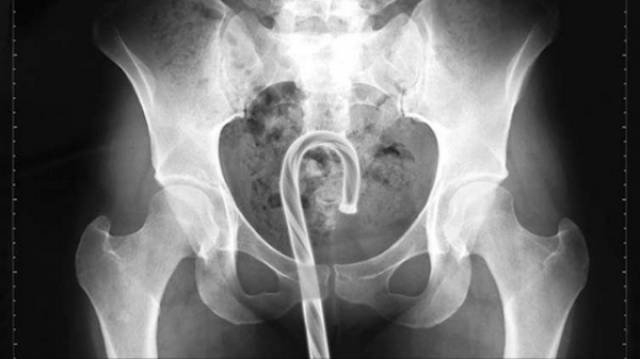 xrays_020