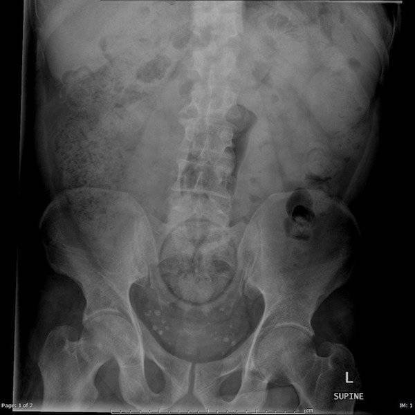 xrays_021