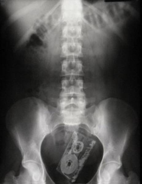 xrays_022