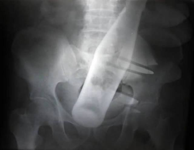 xrays_024