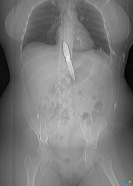xrays_025