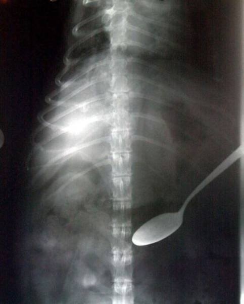 xrays_028