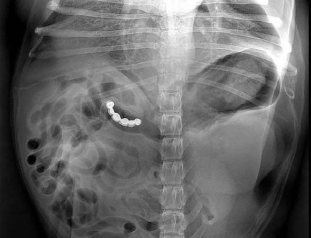 xrays_033