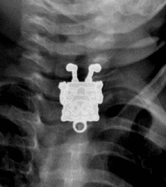 xrays_039