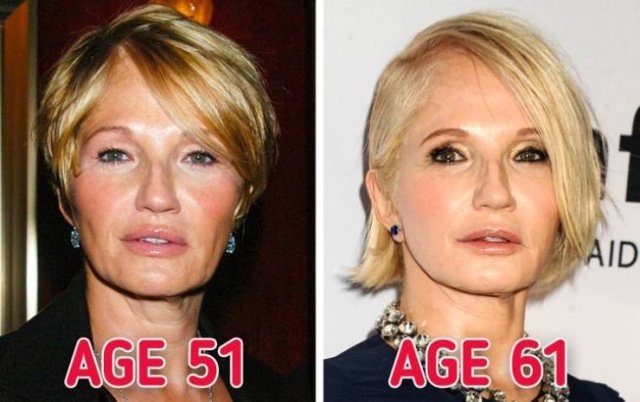 celebritiesthennow10_007