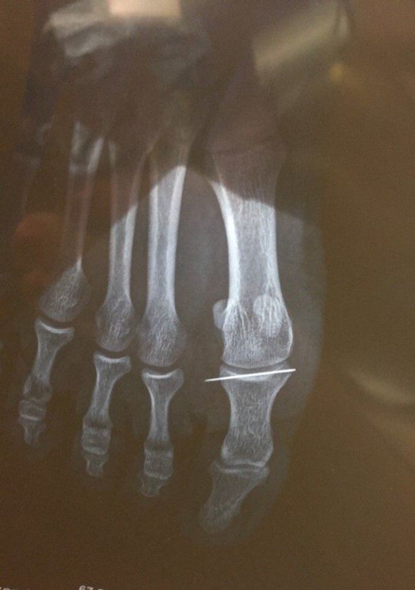 fails51_015