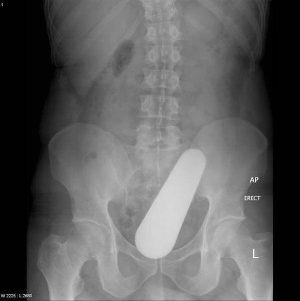 xrays2_001