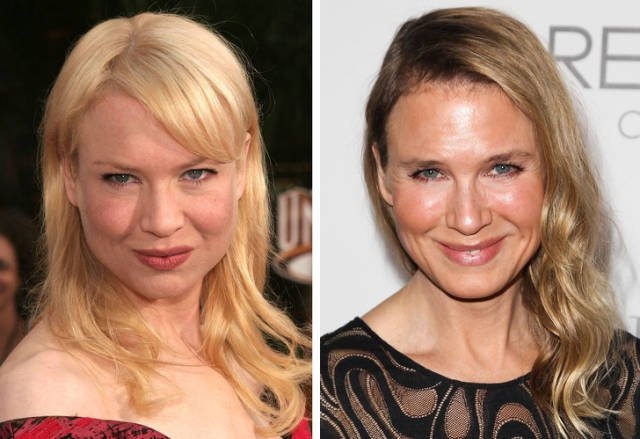 celebritieswithoutplasticsurgeries2_003