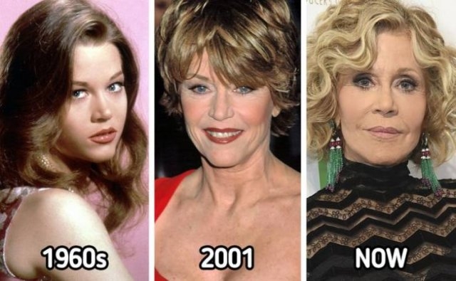 celebritiesthennow12_018