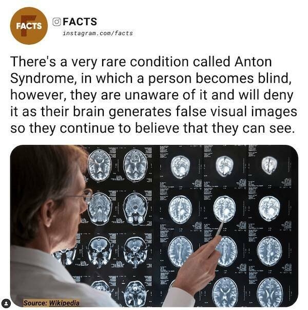 interestingfacts78_014
