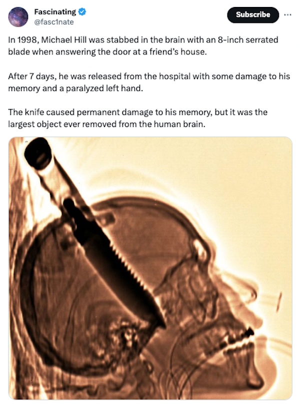 interestingfacts84_026