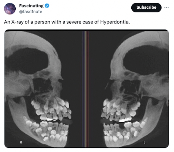 interestingfacts84_029