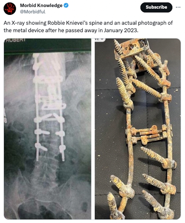 interestingfacts87_003