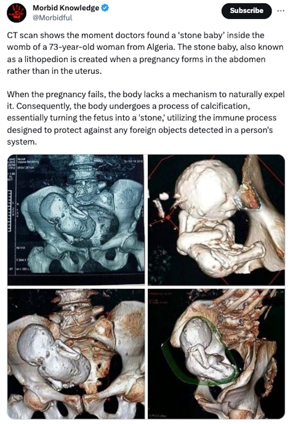 interestingfacts87_024