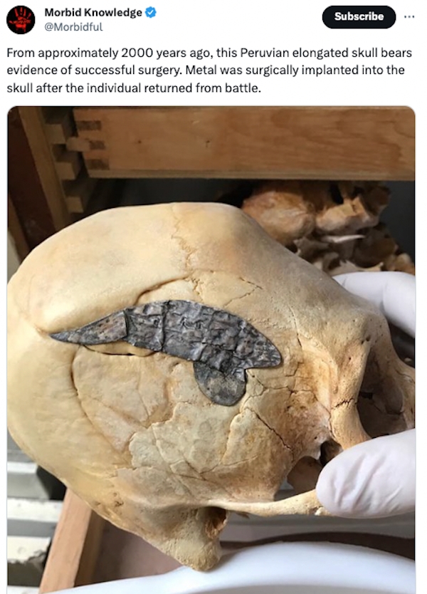 interestingfacts87_025