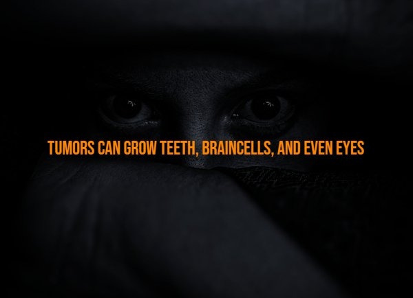 interestingfacts313_008