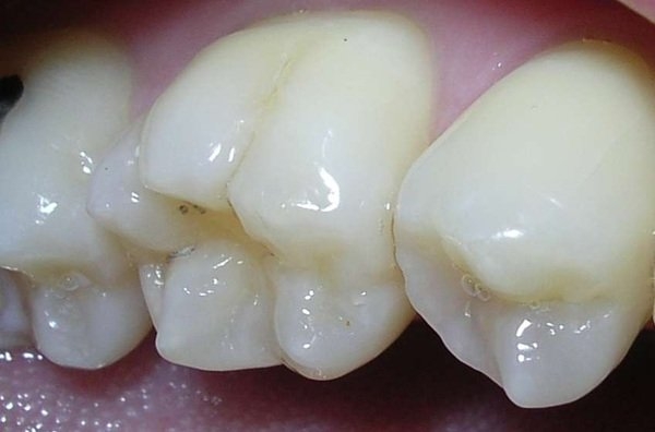 interestingfacts319_017