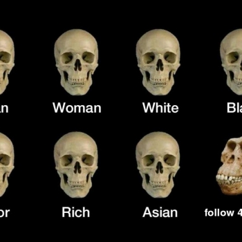 H1XZKXDVA